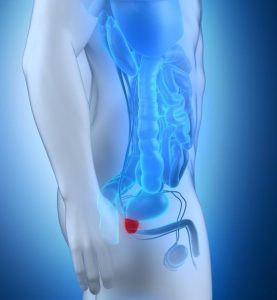Inflammation de la prostate