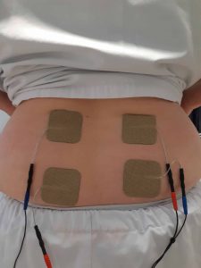 Neurostimulation électrique transcutanée