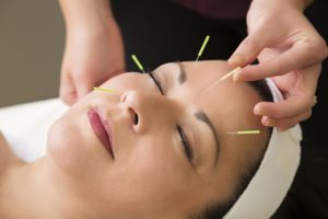 L’acupuncture pendant la grossesse