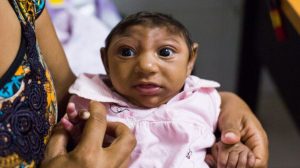 Virus Zika et grossesse